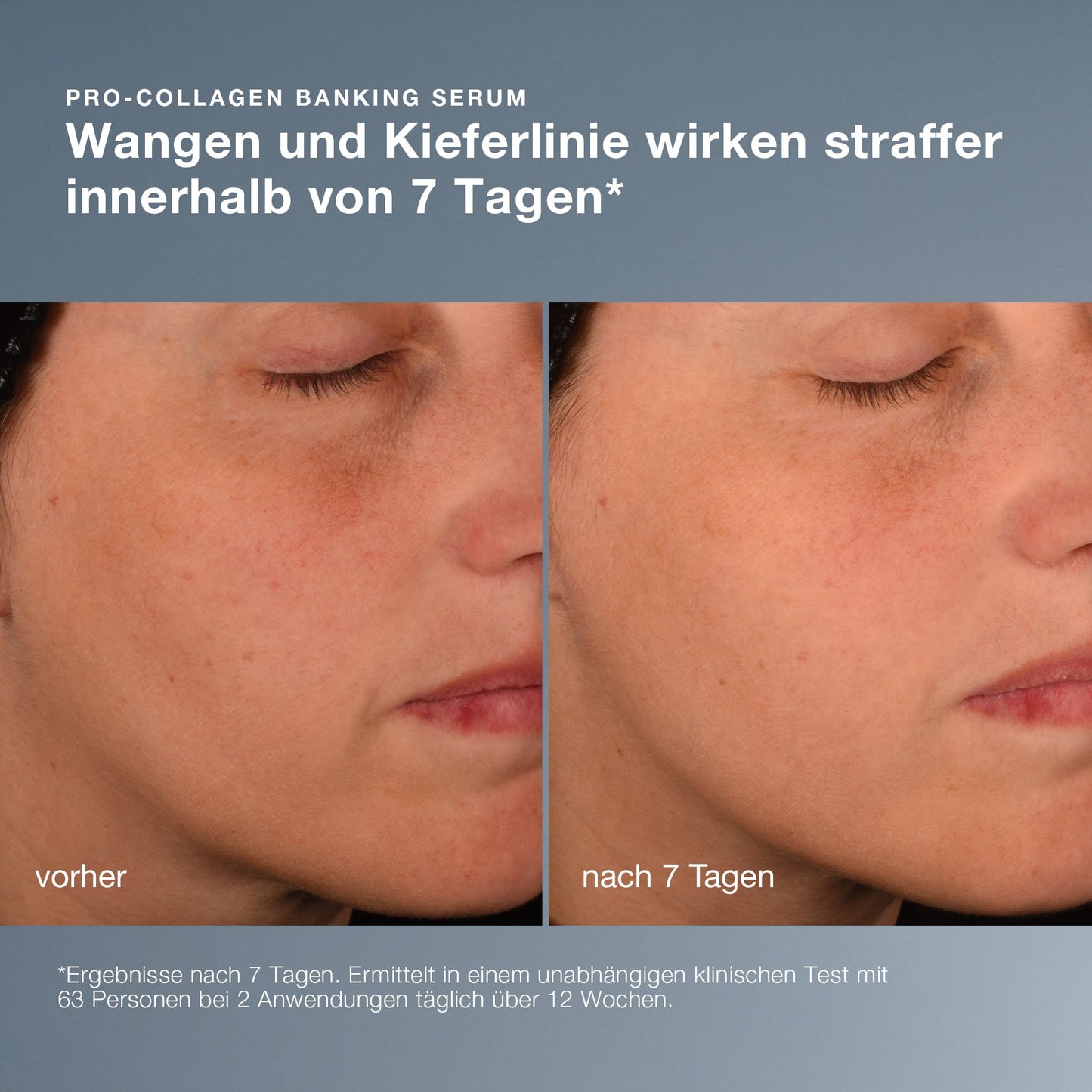 Nahaufnahme der Wange und der Kinnlinie einer Frau, links ein „Vorher“-Bild und rechts ein „Nach 7 Tagen“-Bild, das die sichtbar glattere und straffere Haut nach der Anwendung von „Hydration You Can Feel“ verdeutlicht.