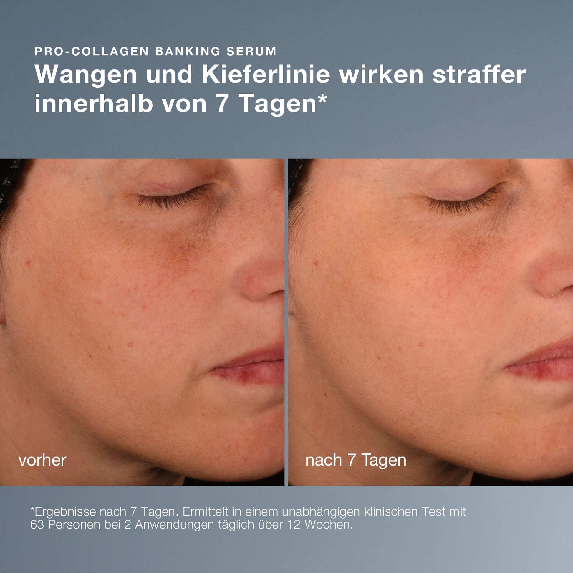 Nahaufnahme der Wange und der Kinnlinie einer Frau, links ein „Vorher“-Bild und rechts ein „Nach 7 Tagen“-Bild, das die sichtbar glattere und straffere Haut nach der Anwendung von „Hydration You Can Feel“ verdeutlicht.