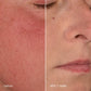 Nebeneinander angeordnete Nahaufnahmen von empfindlicher Haut, die nach einer Woche Anwendung des Stabilizing Repair Serums und der Stabilizing Repair Creme weniger Rötungen und eine glattere Haut zeigen, beschriftet mit „vorher“ und „nach 1 Woche“.