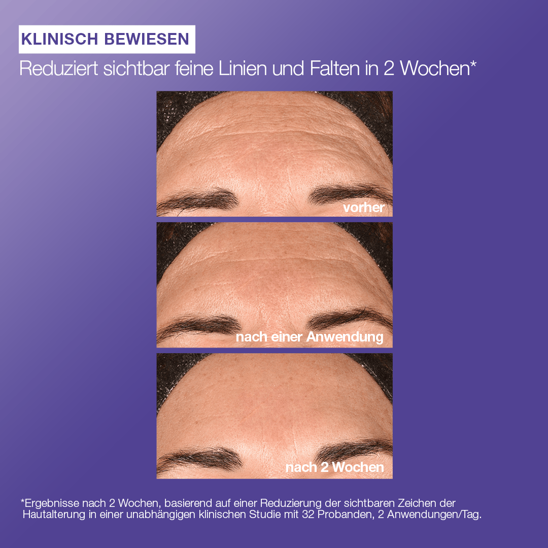 Drei Nahaufnahmen der Stirn zeigen die Reduzierung feiner Linien und Falten vor der Anwendung, nach einer Anwendung und nach zwei Wochen Phyto Nature E2 Exosom Treatment. Der deutsche Text erklärt die Rolle des Produkts bei der Regeneration der Haut.