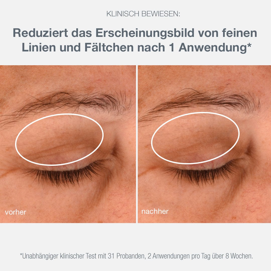 Vorher- und Nachher-Nahaufnahmen der Augenpartie einer Person, die eine Verringerung der feinen Linien und Fältchen nach einer Hautpflegebehandlung mit Phyto Nature Lifting Eye Cream zeigen | Augenpflege mit Lifting-Effekt.