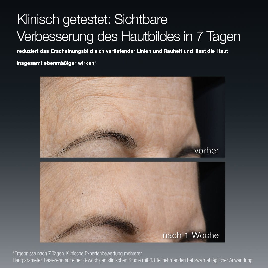 Nahaufnahme der Stirn einer Person vor und nach einer Woche, mit reduzierten Falten und glatterem Hautbild. Der Text hebt die sichtbare Verbesserung der Haut in 7 Tagen mit FutureCode Booster für optimale Hautregeneration hervor.