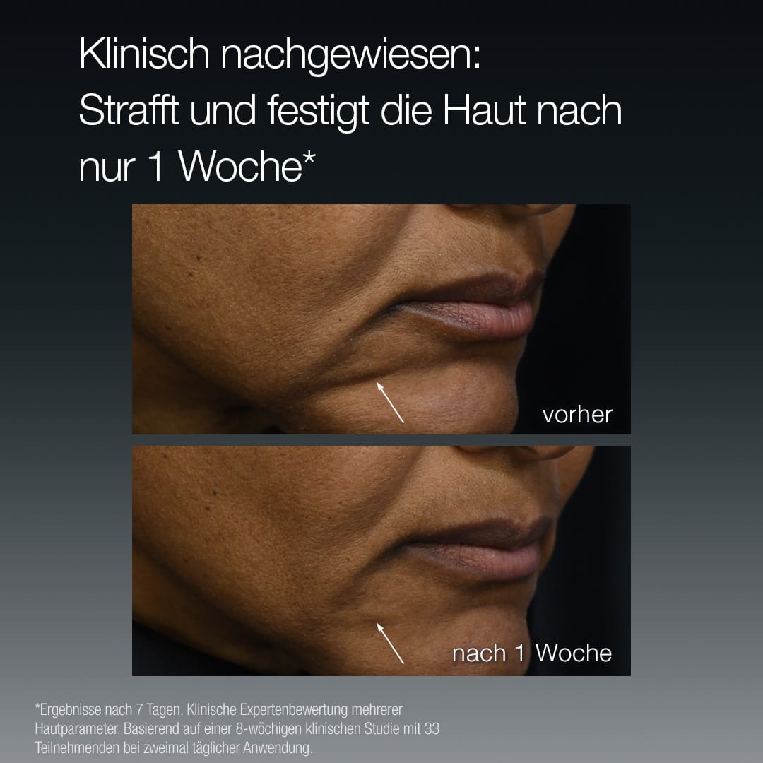 Nahaufnahme des unteren Gesichts einer Person vor und nach einer Woche Anwendung von FutureCode Booster; das zweite Bild zeigt eine straffere, glattere Haut. Der deutsche Text beschreibt die klinischen Ergebnisse zu den Zeichen der Hautalterung.