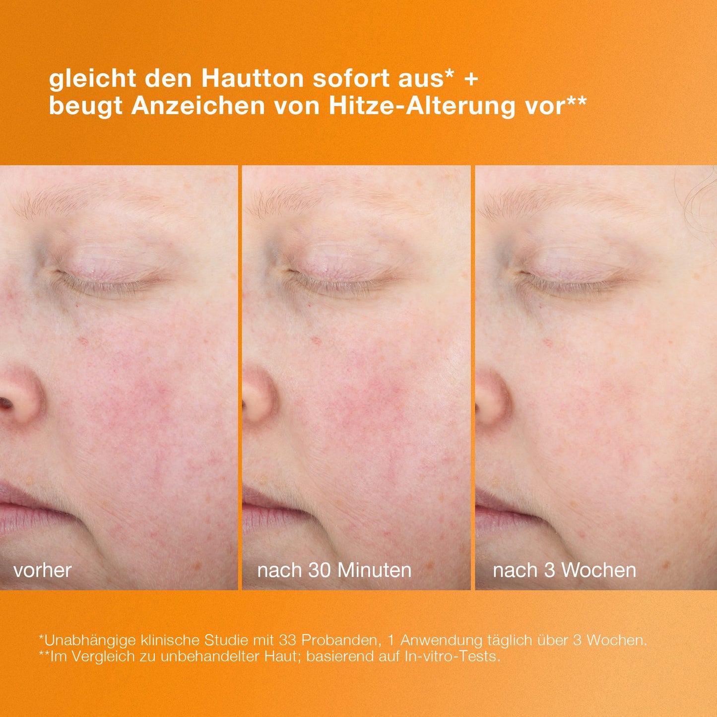 Nahaufnahmevergleich der Wange einer Person, der die Verbesserung des Hautbildes im Zeitverlauf zeigt – vor der Anwendung, nach 30 Minuten und nach 3 Wochen – mit einem deutschen Text über den „Biolumin-C Heat Aging Protector LSF 50“ für einen gleichmäßigen Teint und wirksamen Anti-Aging-Schutz.