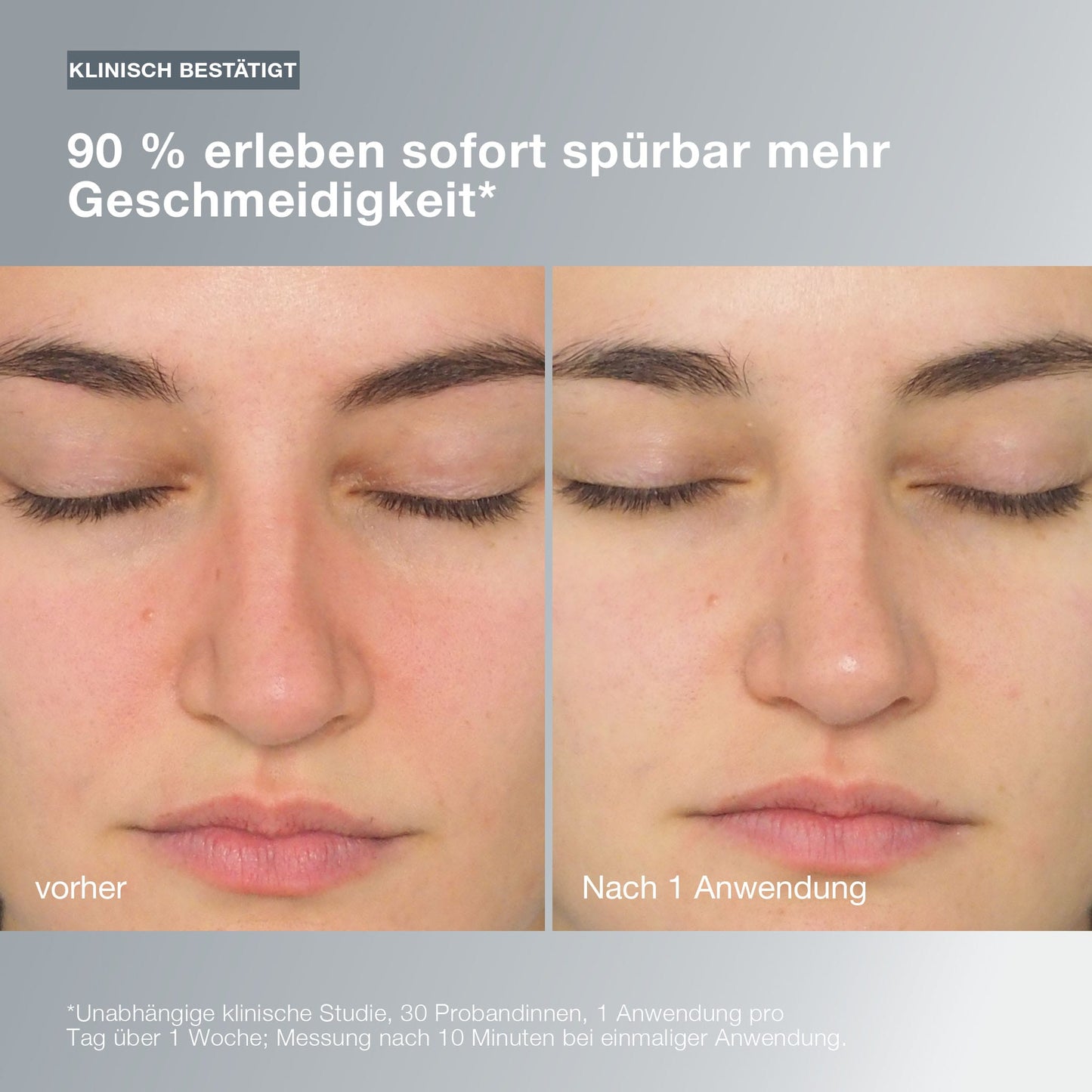 Nahaufnahme des Gesichts einer Frau vor und nach der Anwendung von Daily Milkfoliant, die die Hauterneuerung für empfindliche Haut zeigt, beschriftet mit "vorher" und "nach 1 Anwendung".