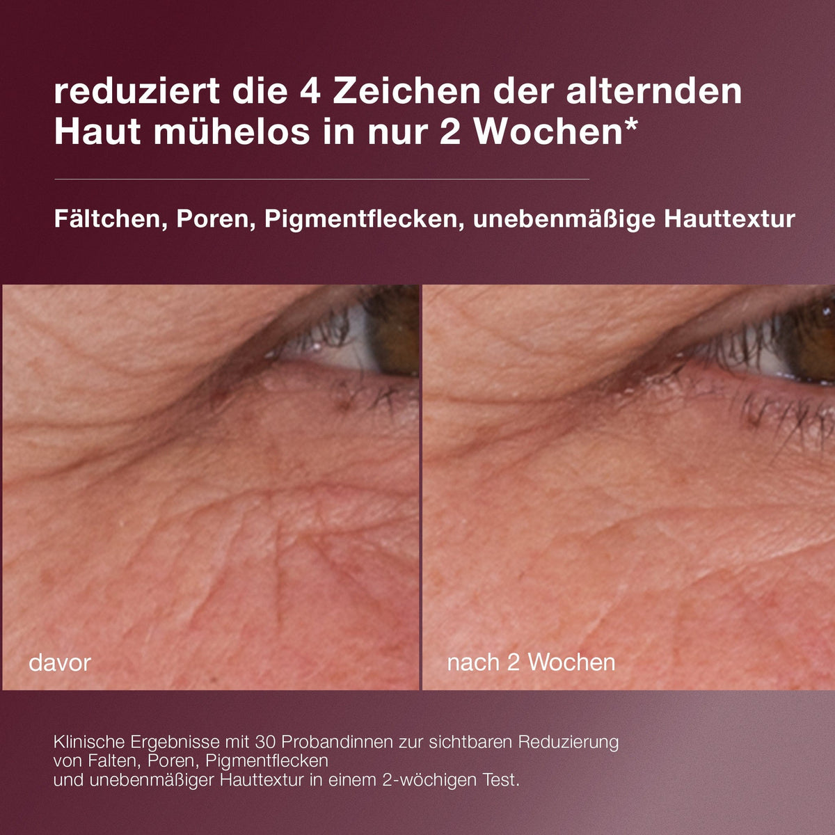 Nahaufnahme der Haut um ein Auge herum, die die Ergebnisse "vor" und "nach 2 Wochen" mit Dynamic Skin Retinol Serum zeigt, wobei die reduzierten Falten und die verbesserte Hautstruktur hervorgehoben werden.