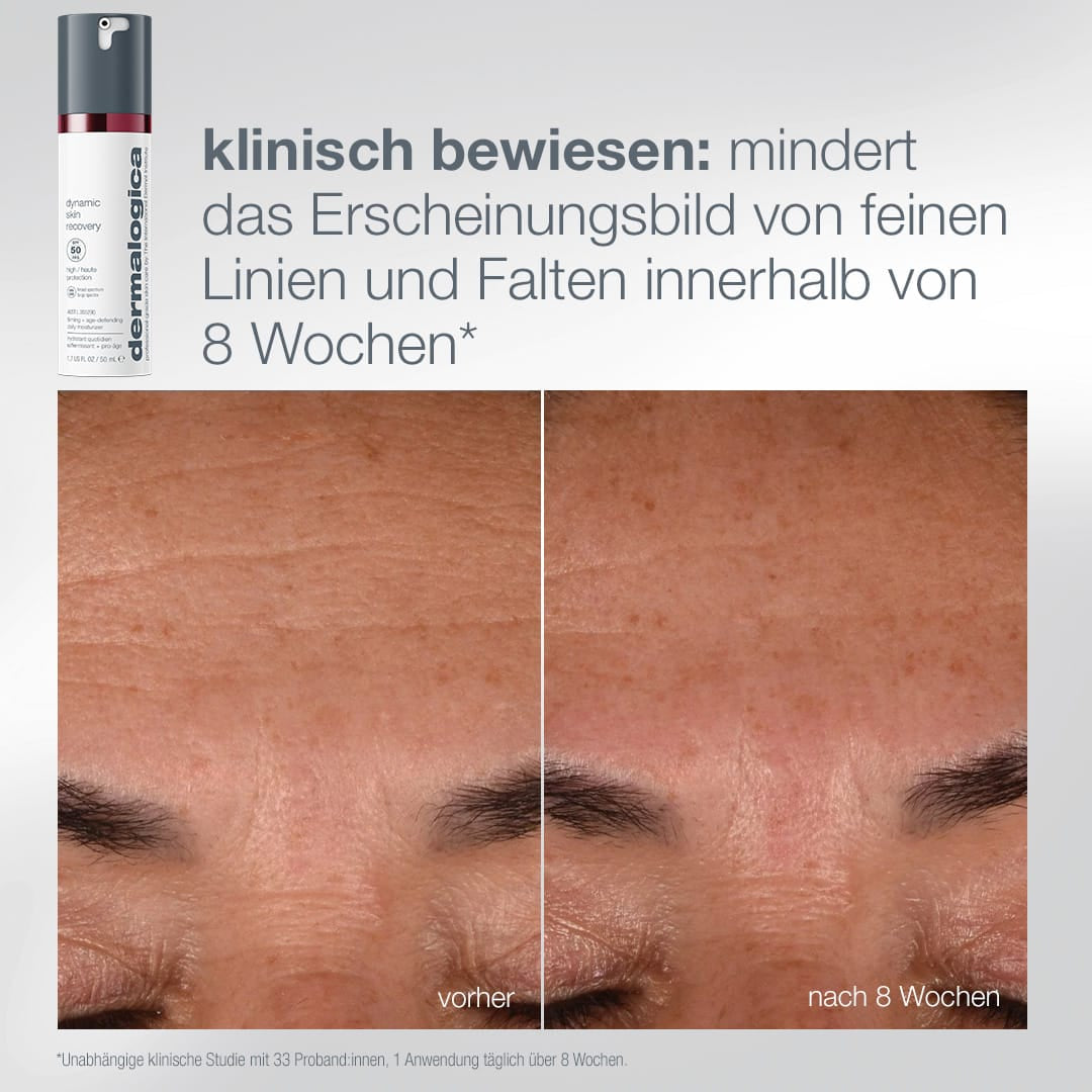 Nahaufnahme der Stirnhaut, die den Zustand „vorher“ mit deutlicheren feinen Fältchen und den Zustand „nach 8 Wochen“ mit gemilderten Fältchen zeigt und damit die Wirksamkeit des Expert Protect + Renew-Sets bei der sichtbaren Minderung von Hautalterungserscheinungen unterstreicht.