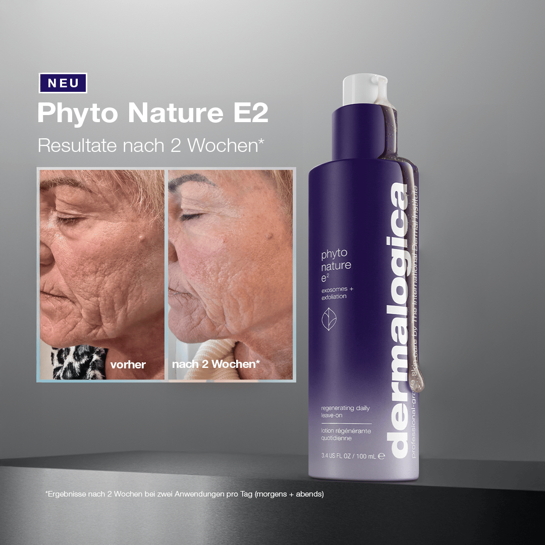 Nahaufnahme des Gesichts einer älteren Frau vor und nach einer zweiwöchigen Phyto Nature e² Exosom-Behandlung, die eine sichtbare Regeneration der Haut zeigt, mit Abbildung der Produktflasche.