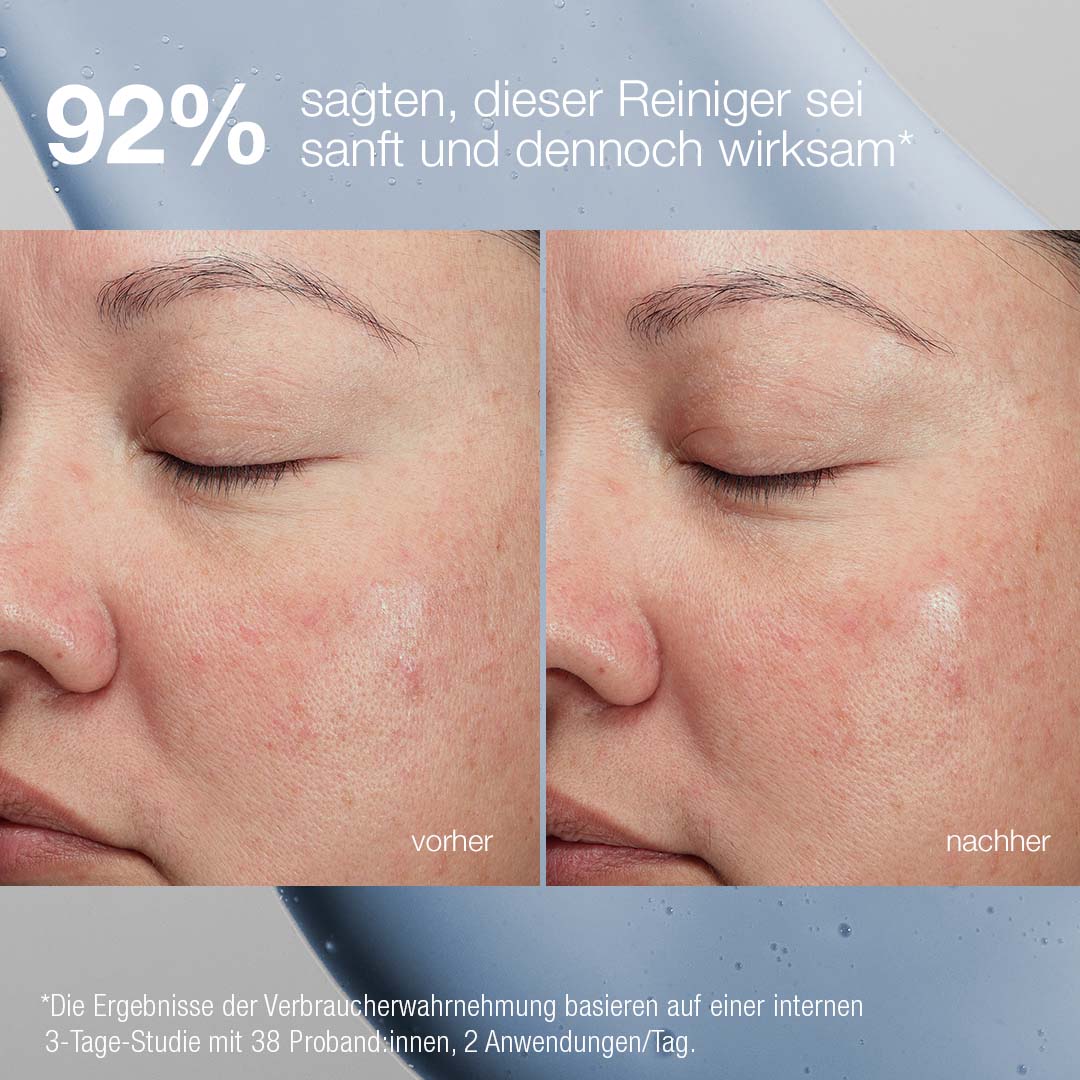 Nahaufnahme der Wange einer Person vor und nach der Anwendung des Magnetic[+] Afterglow Cleansers. Der Test zeigt reduzierte Rötungen, glattere Haut und verbesserte Feuchtigkeitsversorgung. 92 % der Befragten empfanden den Reiniger als sanft und dennoch wirksam.
